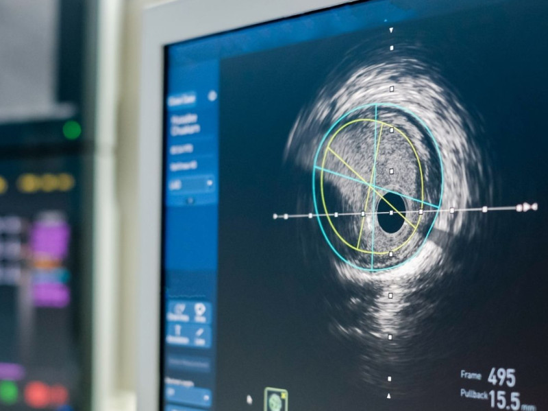 medical scan on a computer