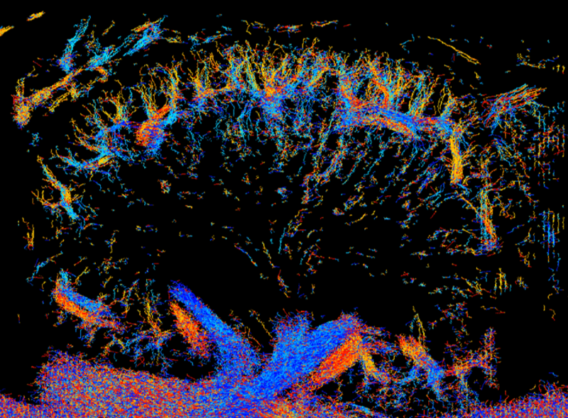 medical imaging of kidney